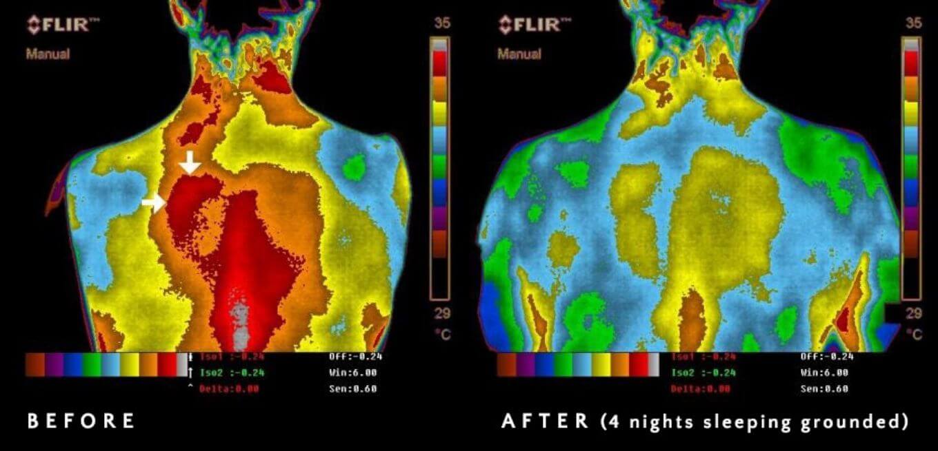 Thermal imaging showing inflammation before and after 4 nights of grounding